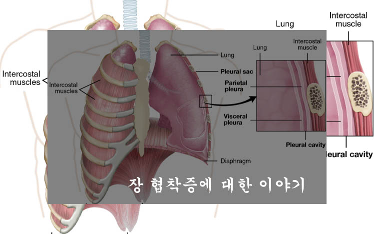  장 협착증 이란? 증상, 원인, 치료 및 예방법, 좋은 음식- 알아두면 좋아요!