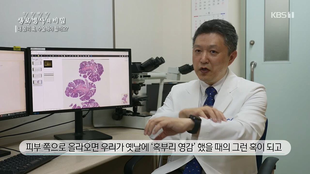 생로병사의 비밀.E870.230532p.H264-F1RST.mp4_20230605_201518.113.jpg