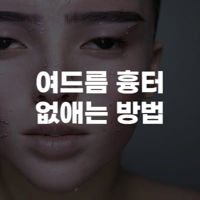 여드름 흉터 없애는 방법