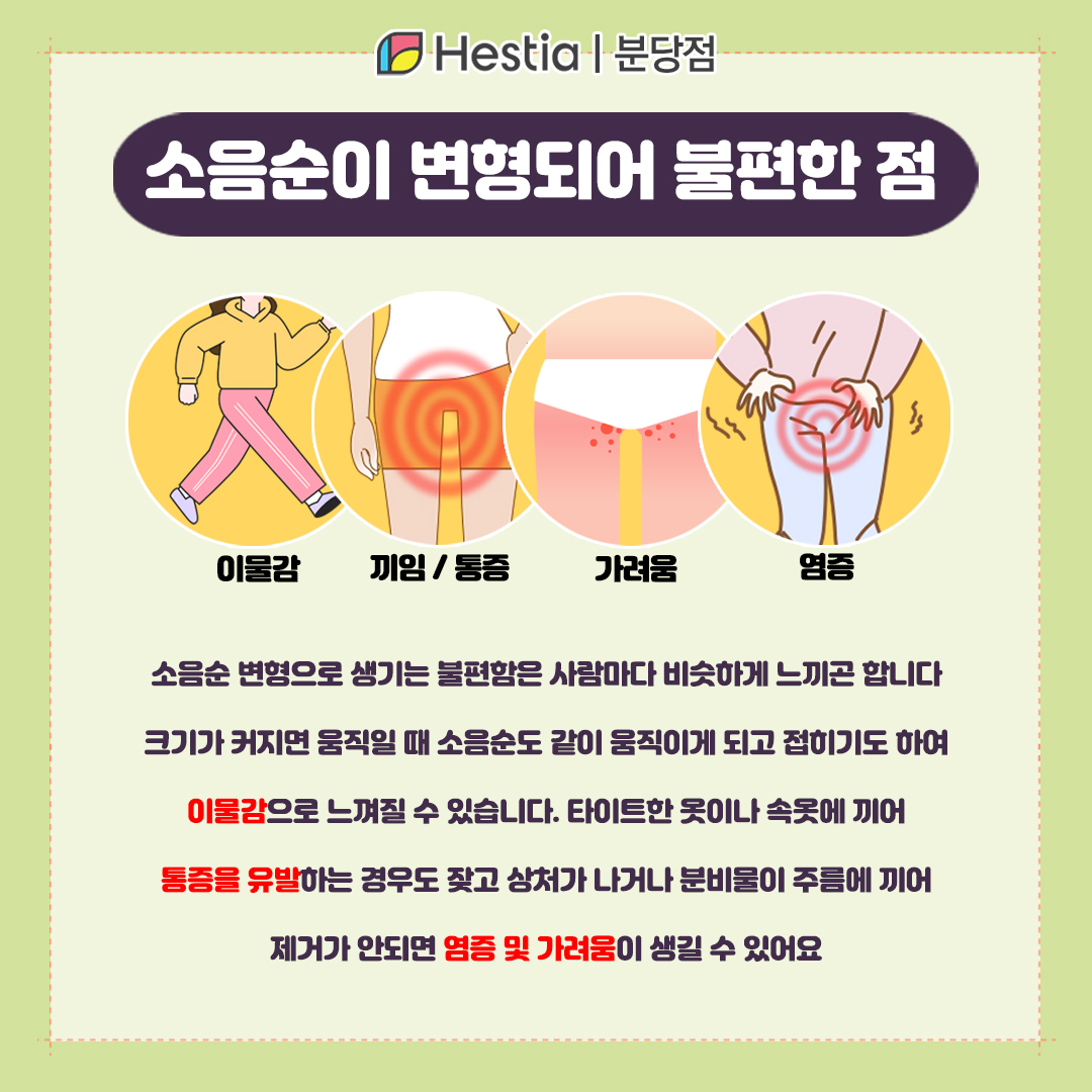 소음순늘어남 미금산부인과 소음순축소술 소음순 변형되면 어떻게 불편할까?