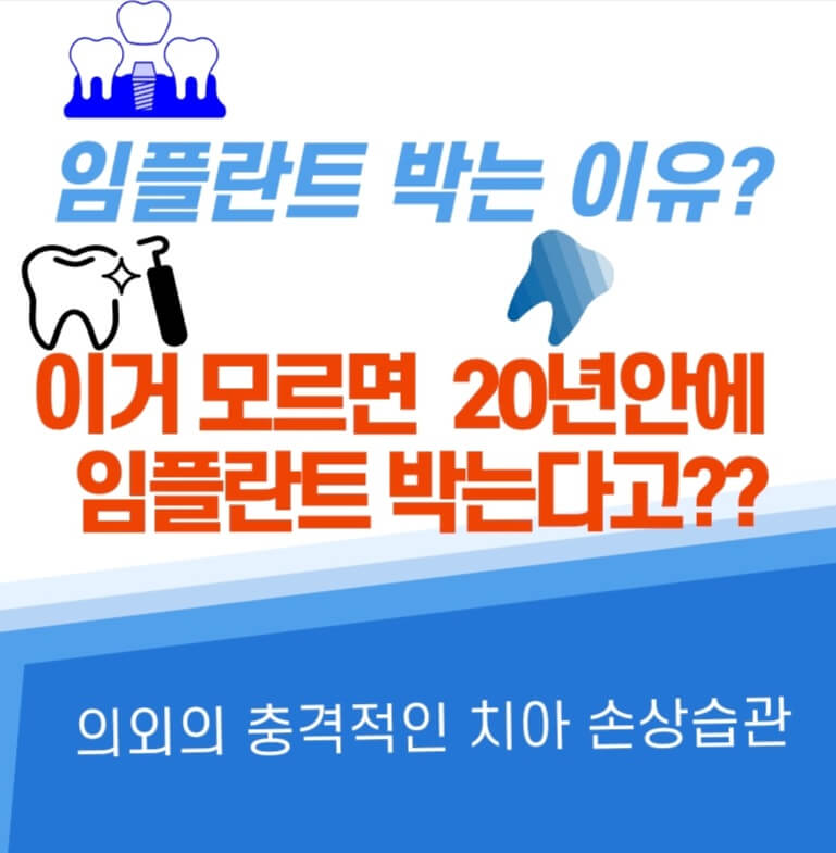  이거 모르면 20년후 임플란트 99%박는다고?? 충격적인 의외의 치아손상습관