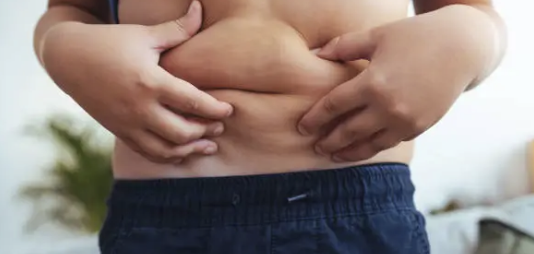어린 시절 비만이 청소년기 및 성인기 비만에 미치는 장기적 영향