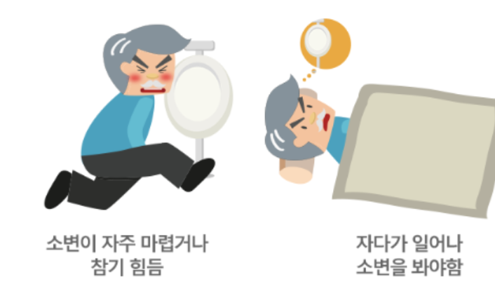 전립선비대증 치료약