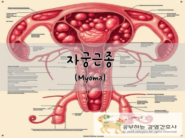 자궁근종(myoma) 이해하기: 원인과 증상 검사 그리고 치료법, 복강경수술 가능여부