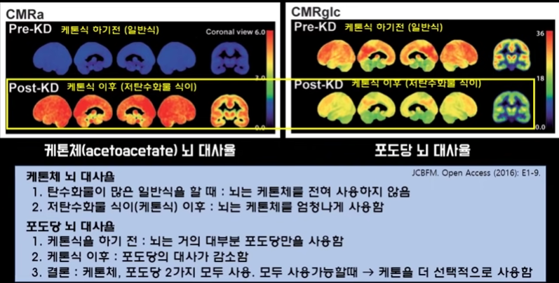 케톤체를 이용한 치매 예방과 뇌활성 증가 연구 논문 설명