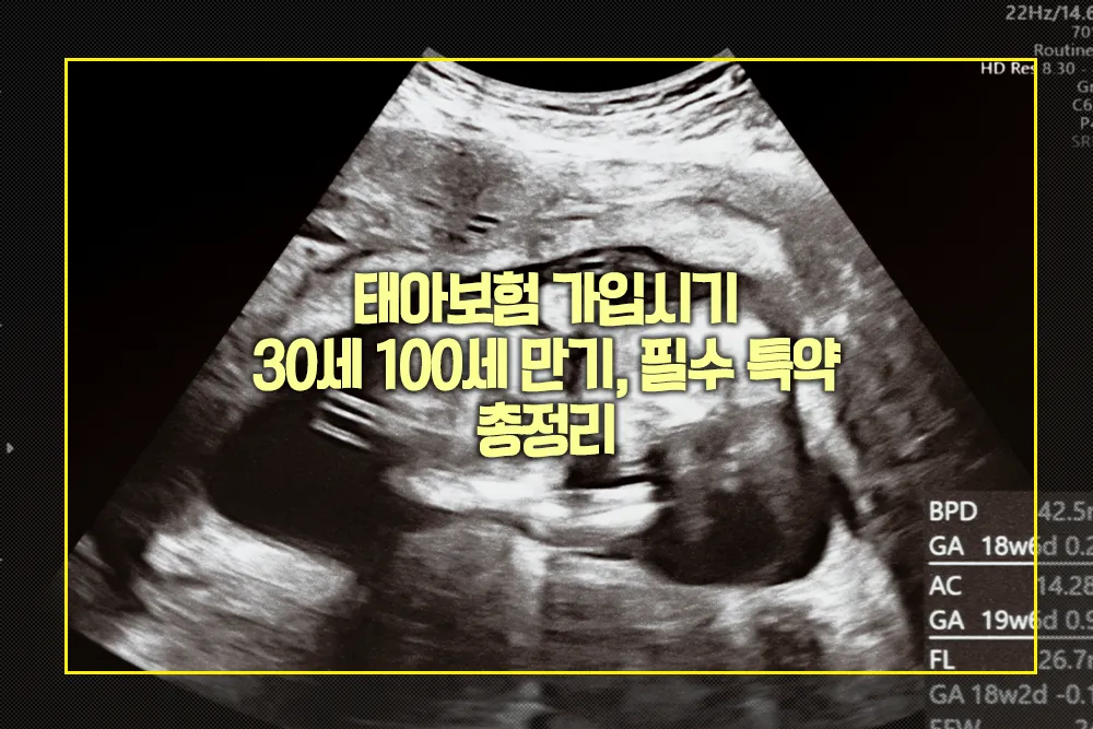 태아보험 가입시기 30세 100세 만기 필수 특약