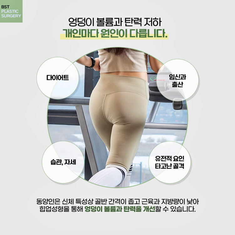 동양인은 신체 특성상 골반 간격이 좁고 근육과 지방량이 낮아 힙업성형을 통해 엉덩이 볼륨과 탄력을 개선할 수 있습니다.