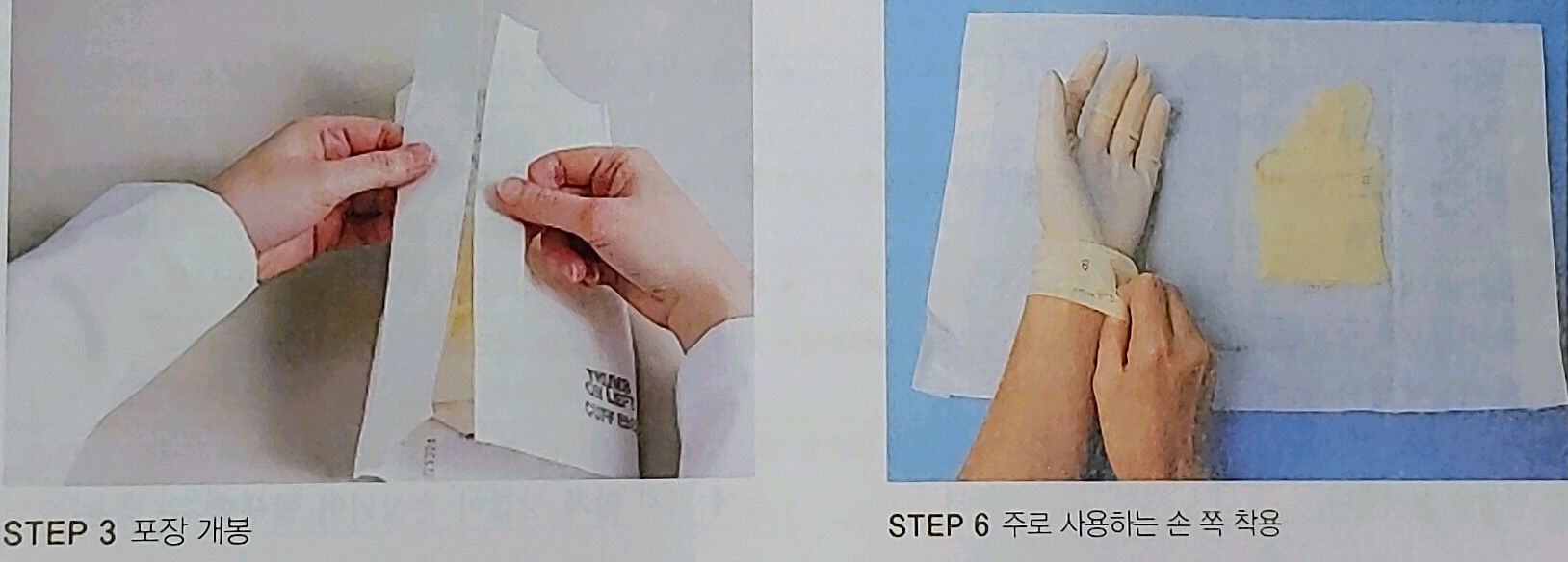  간호술기) 개방식 멸균 글러브 착용법