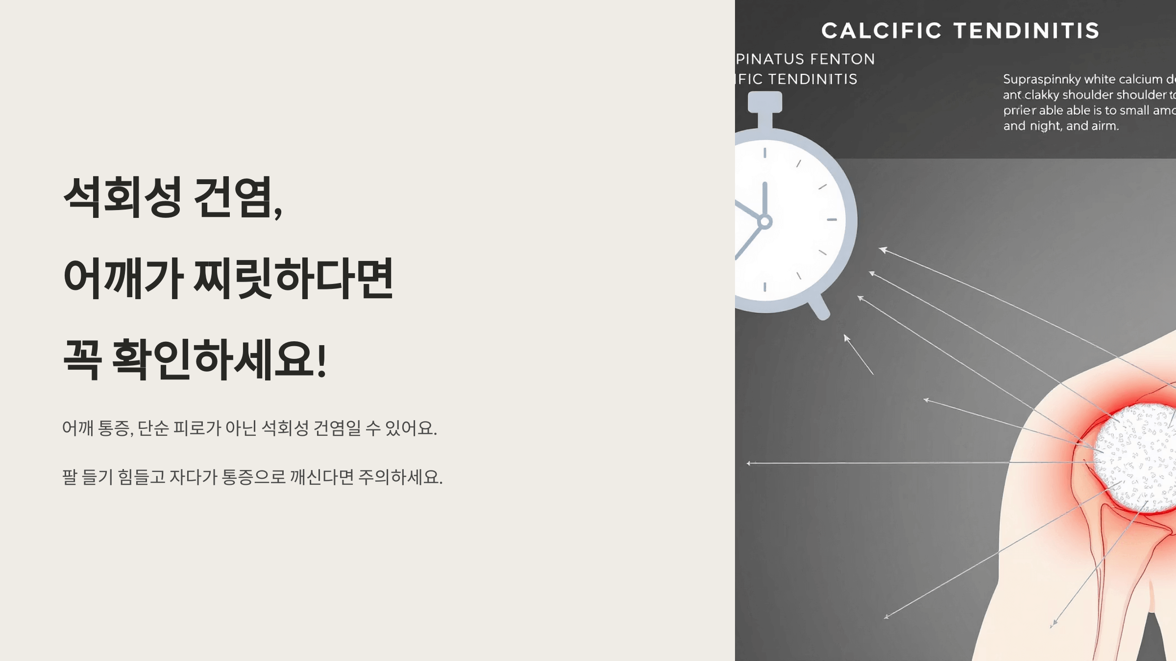 석회성 건염 사진입니다.