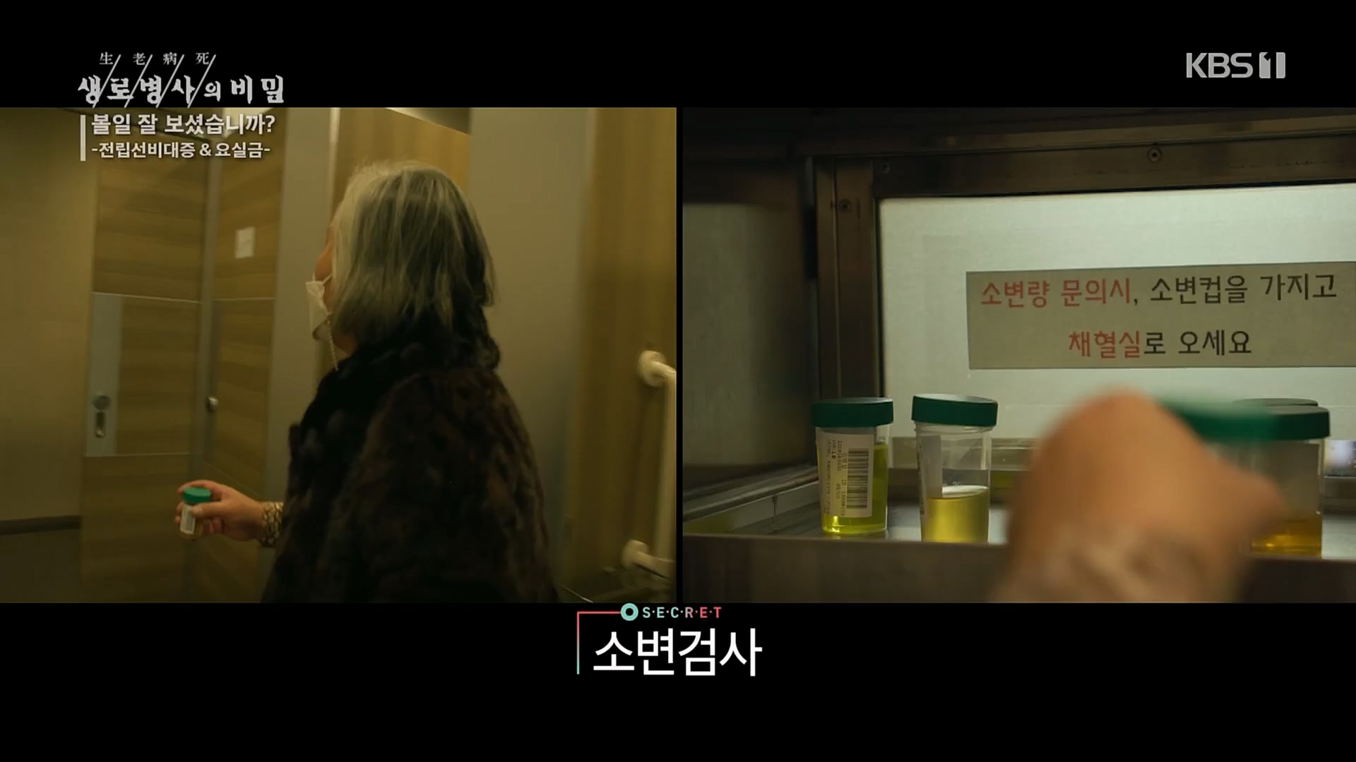 생로병사의 비밀.E856.230215p.H264-F1RST.mp4_20230216_195526.093.jpg