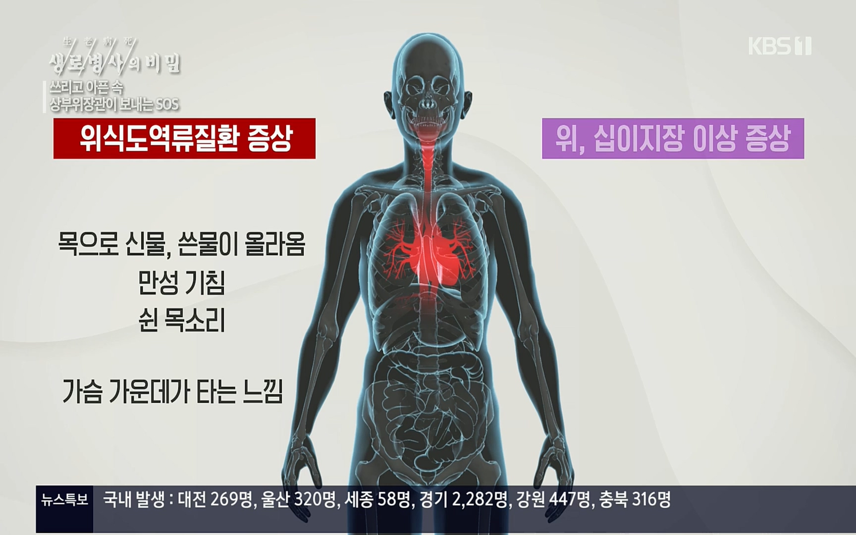 생로병사의 비밀.E822.220615p.H264-F1RST.mp4_20220616_203131.946.jpg