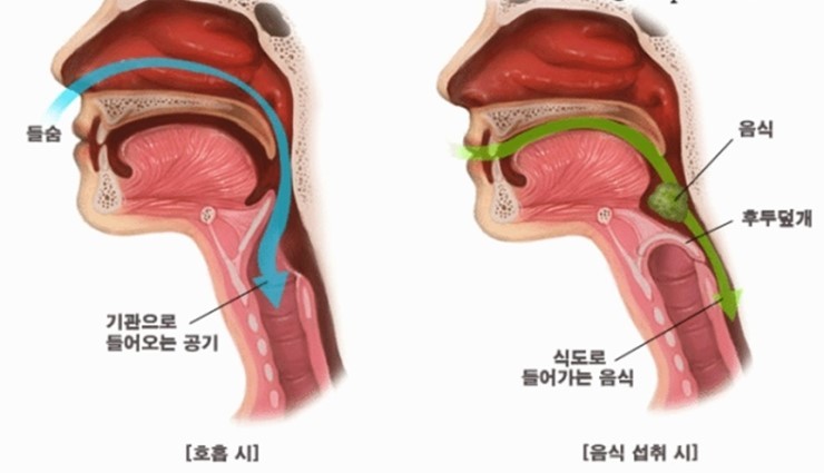 호흡할 때와 음식물 섭취할 때의 후두덮개 기능