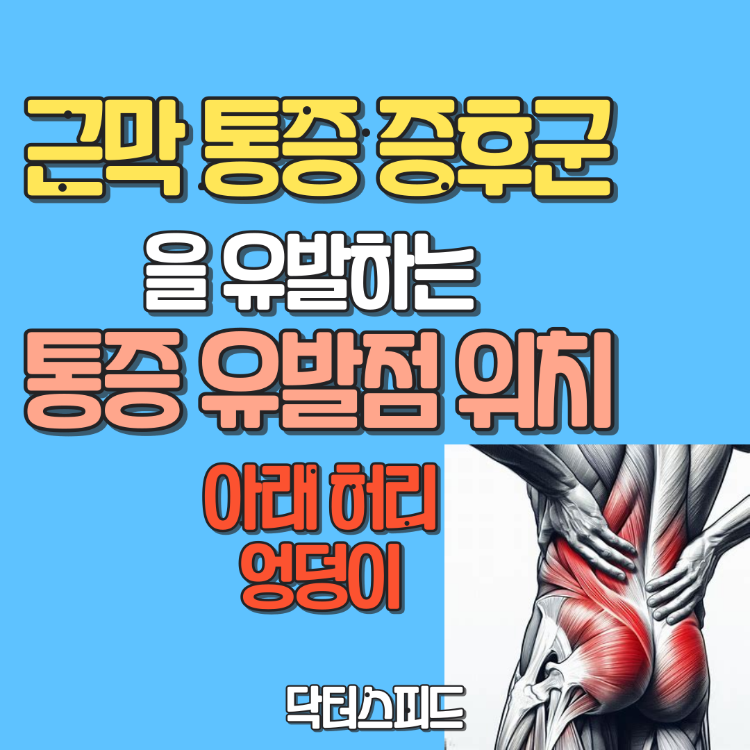 아래허리&#44; 엉덩이 근막 통증 증후군 유발하는 통증 유발점 위치