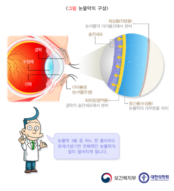 안구건조증증상