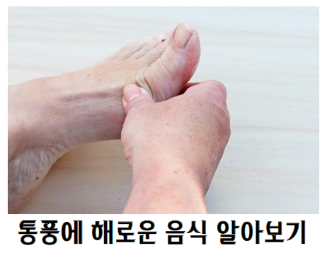 통풍에 해로운 음식 알아보기