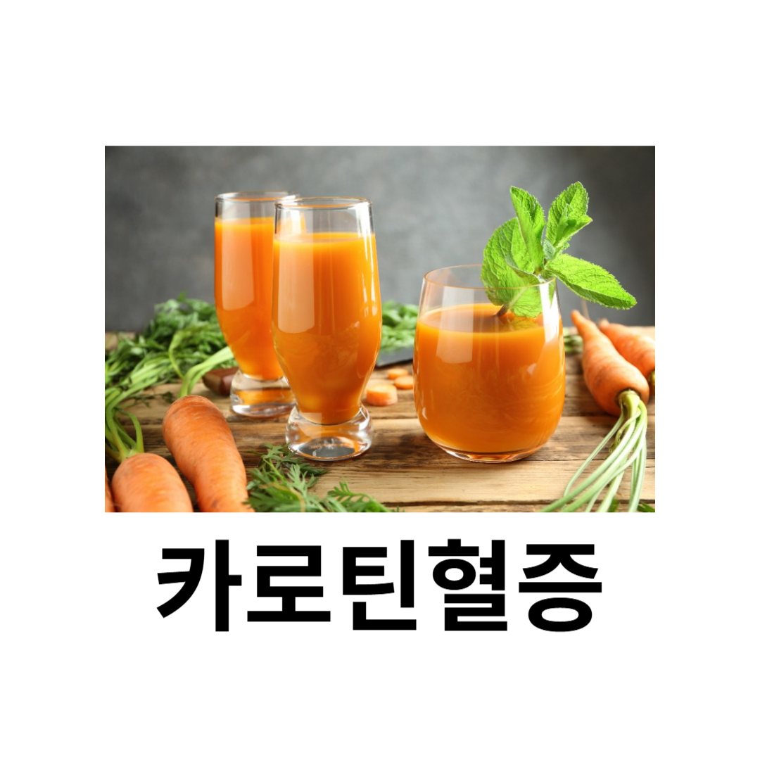 카로틴혈증과 관련된 사진입니다.