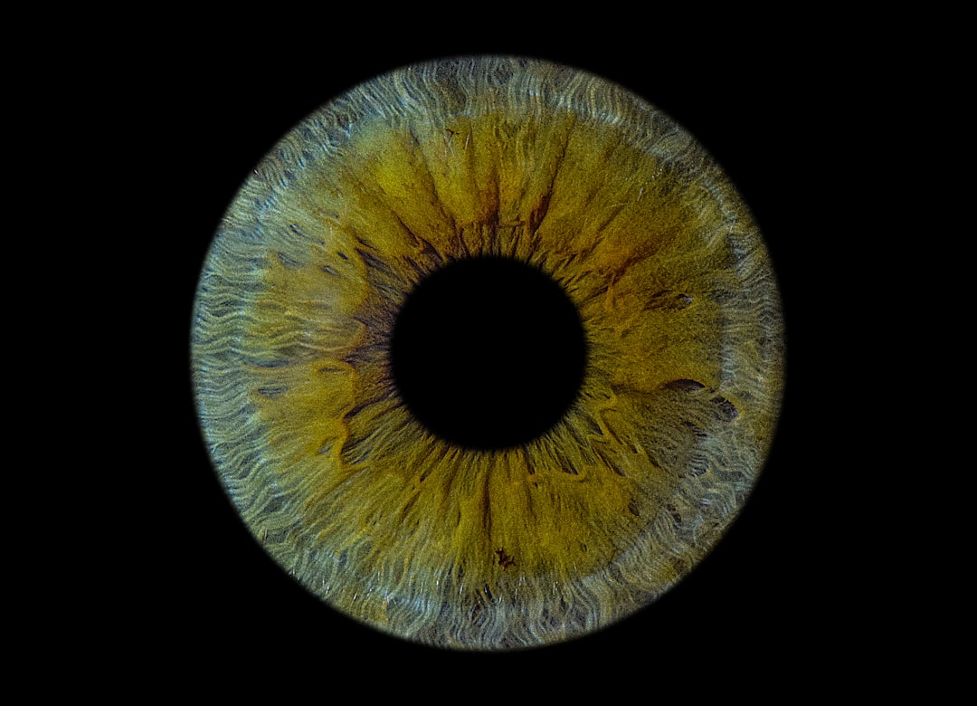 Glaucoma