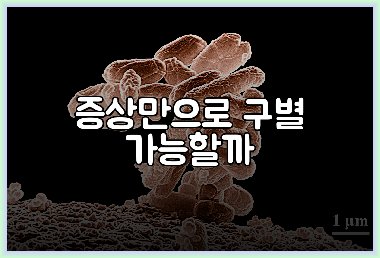 증상만으로 구별 가능할까