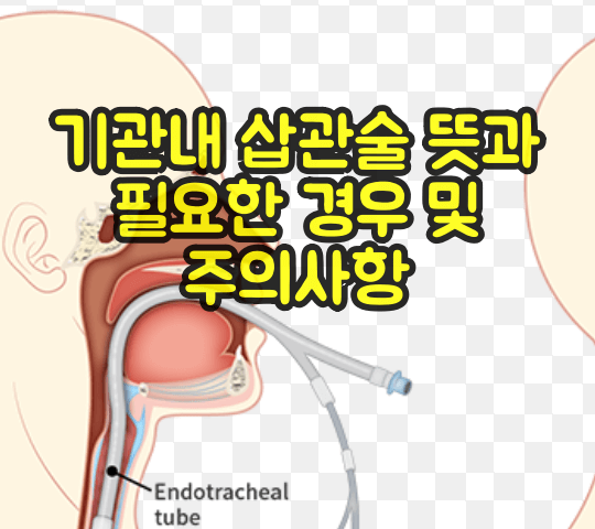 기관내 삽관술 주의사항