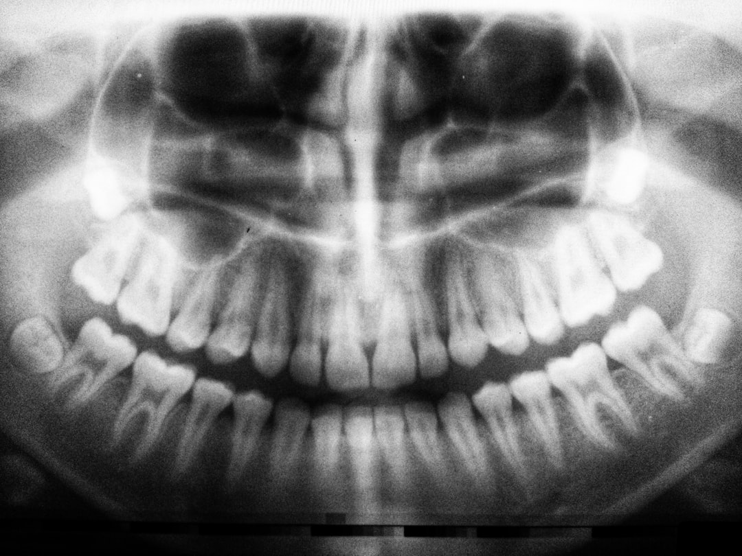 Implant