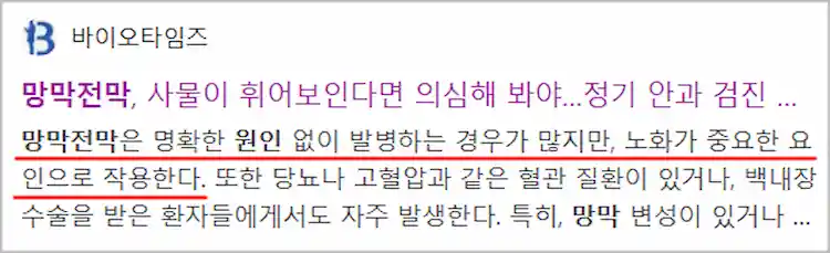 망막전막증 원인 기사 이미지