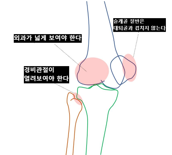 주의점