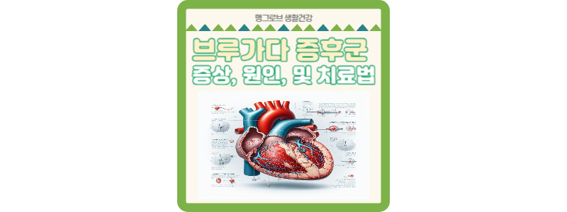 브루가다 증후군 이해하기 썸네일