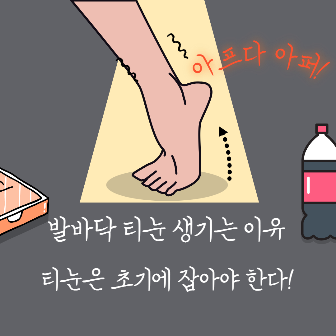  발바닥 티눈 생기는 이유 제거방법 및 티눈 밴드