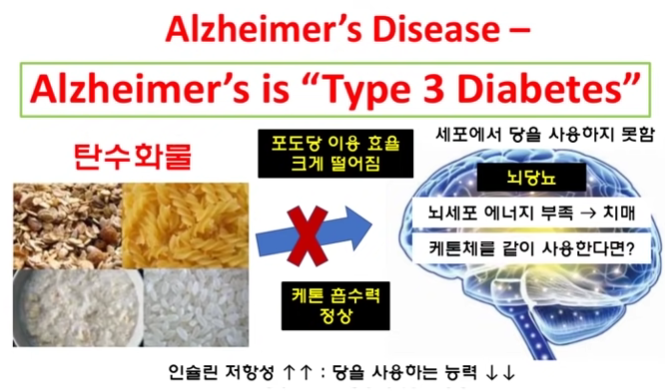 뇌 세포의 에너지 생산이 극도로 떨어진 병이 바로바로 알츠하이머, 즉 치매