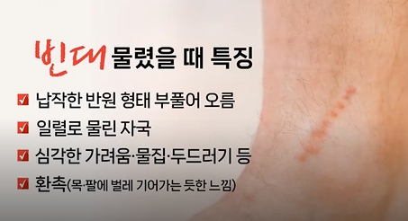 빈대