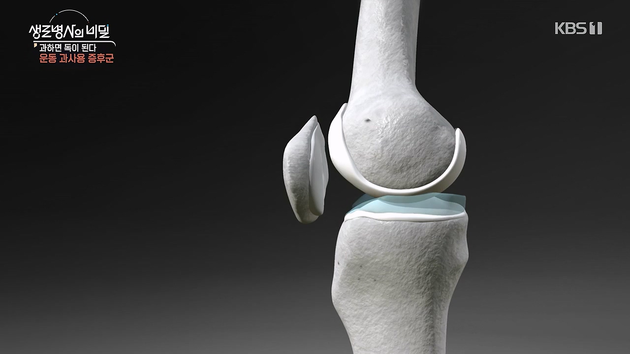 생로병사의 비밀.E918.240704p-NEXT.mp4_20240704_201607.711.jpg