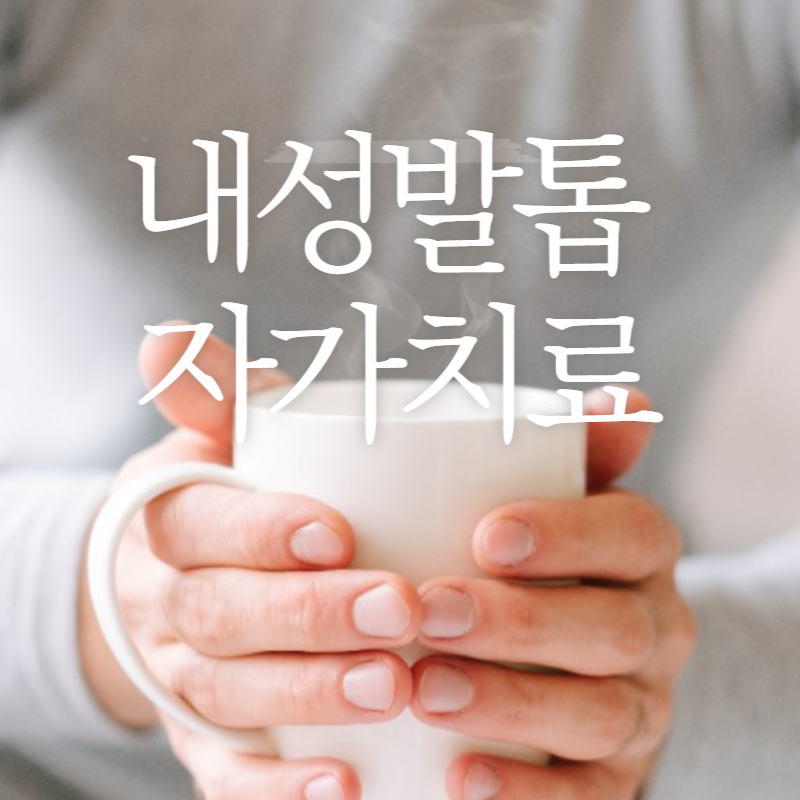 내성발톱 자가치료