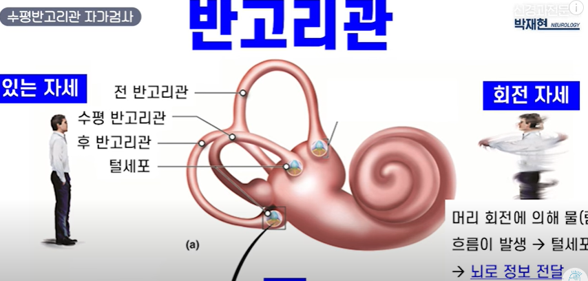 이석증 자가진단 자가치료 방법