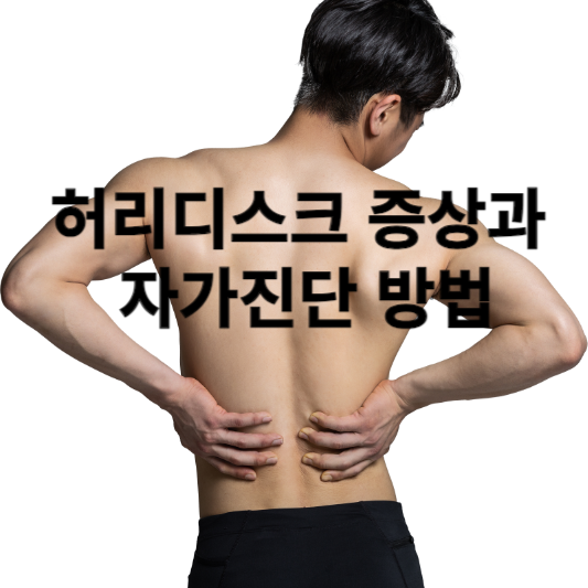 허리디스크 증상과 자가진단 방법