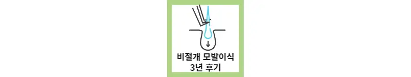 비절개 모발이식 3년 후기