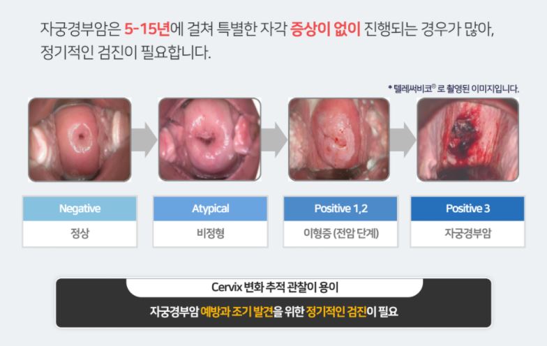 자궁경부암_예방접종