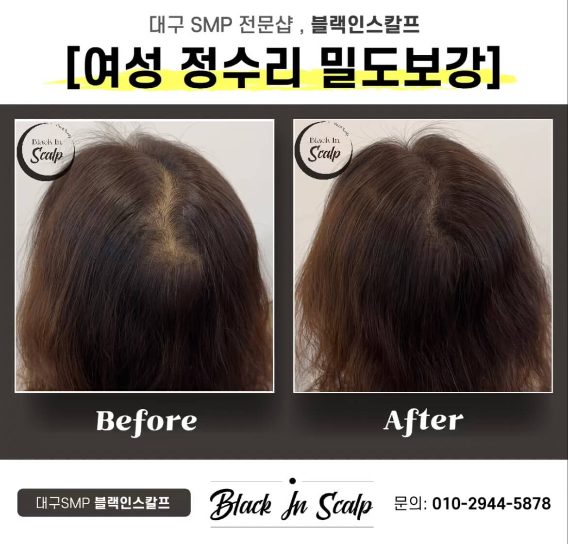 블랙인스칼프 이미지