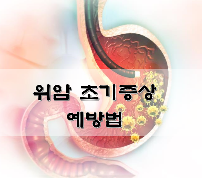 위암 초기증상 예방법
