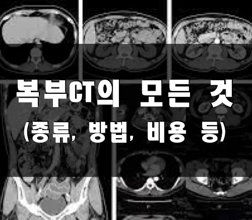 복부CT의 모든 것