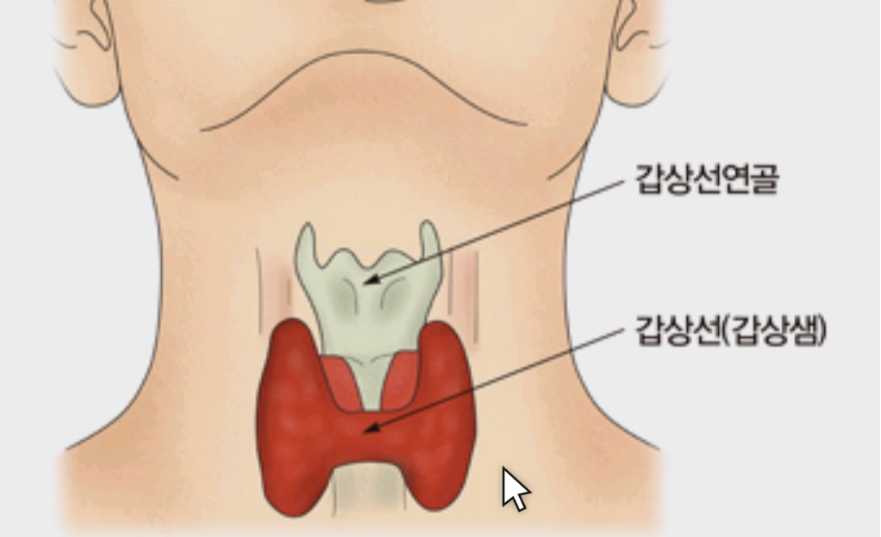  갑상선기능저하증-증상과 원인