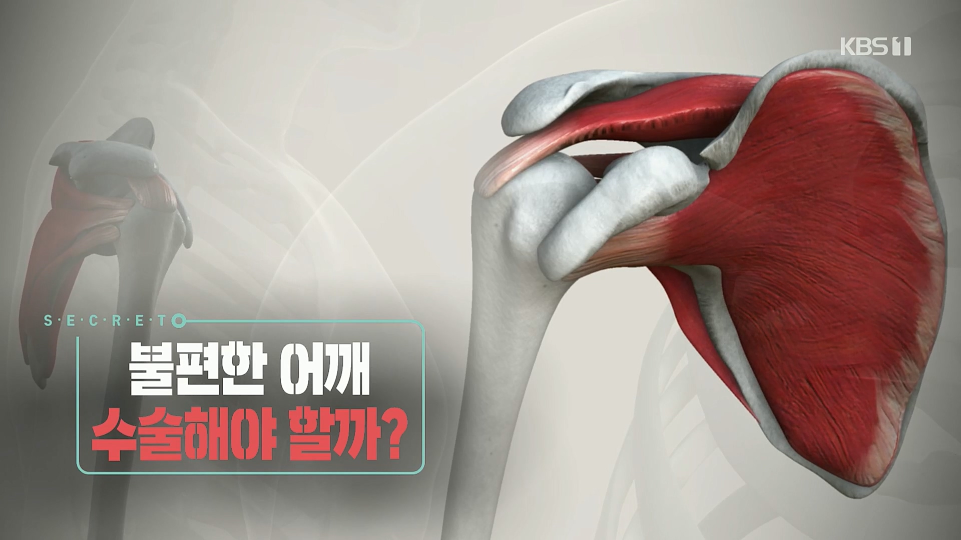 생로병사의 비밀.E848.221221p.H264-F1RST.mp4_20221222_194432.233.jpg