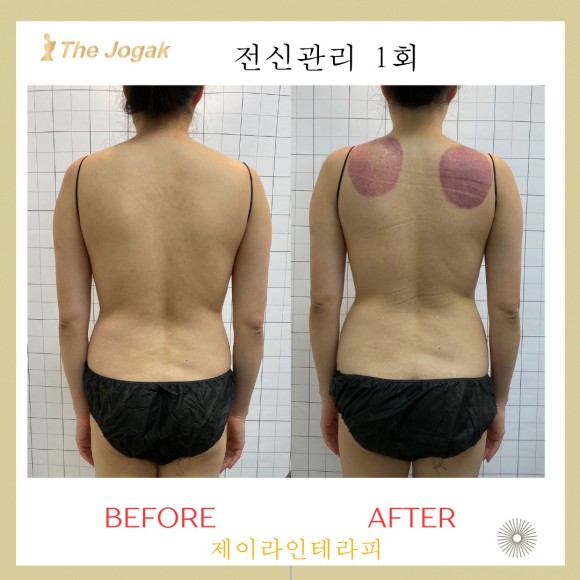제이라인 이미지