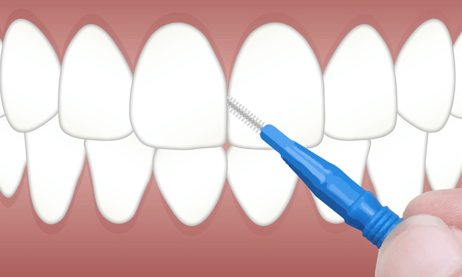 치간 칫솔을 치아 청소를 하고 있다