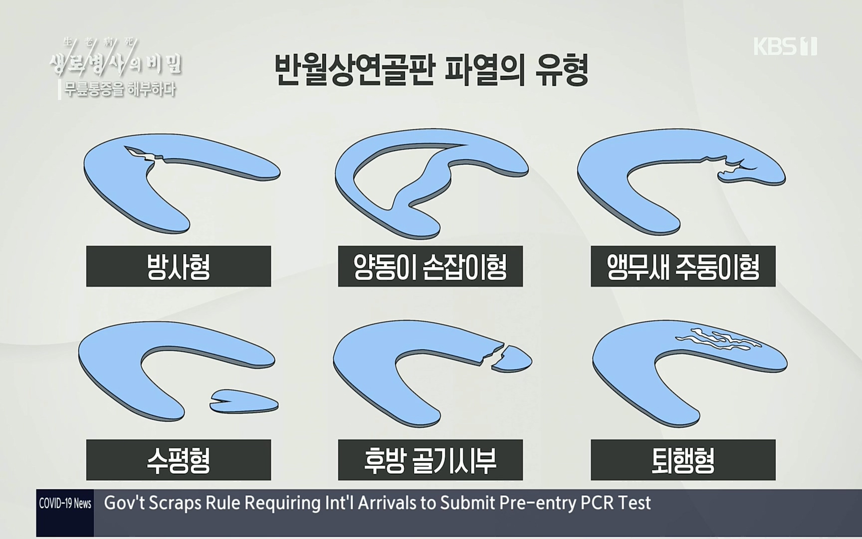 생로병사의 비밀.E834.220907p.H264-F1RST.mp4_20220908_205552.801.jpg