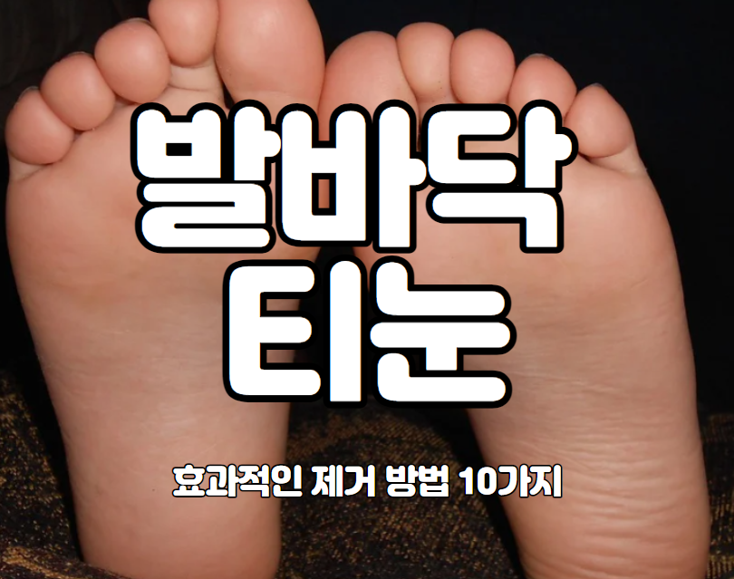  발바닥 티눈 효과적인 제거 방법 7가지