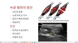 늑골 염좌 회복기간 재활운동_7