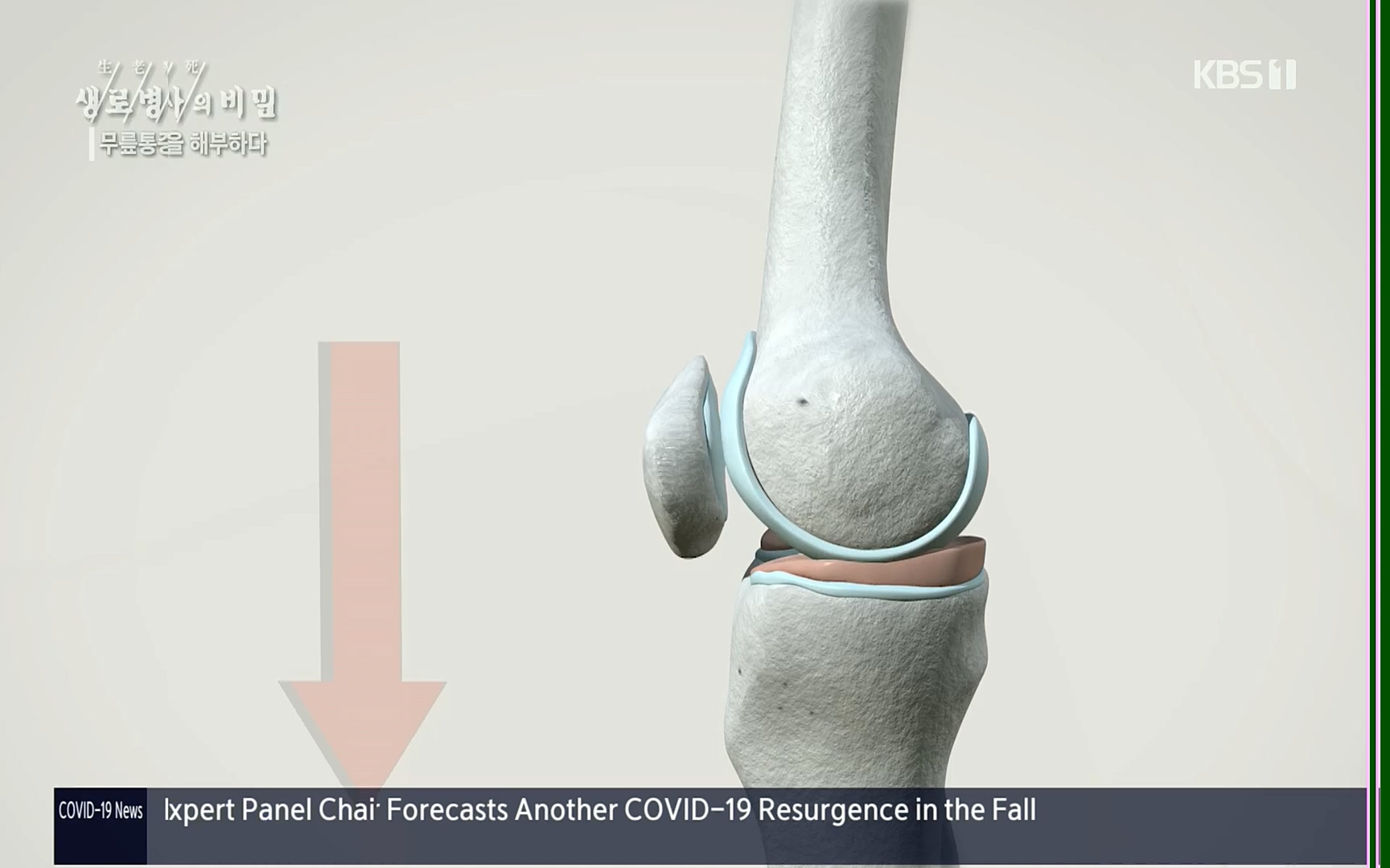 생로병사의 비밀.E834.220907p.H264-F1RST.mp4_20220908_210414.826.jpg