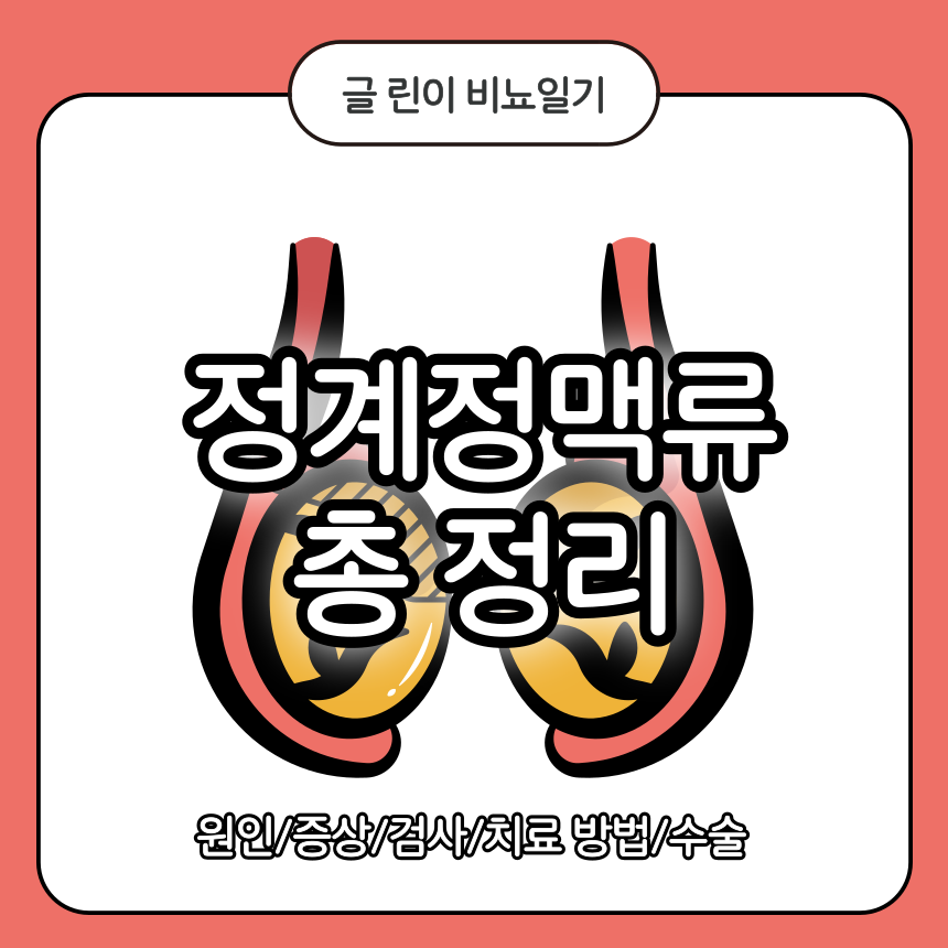 정계정맥류