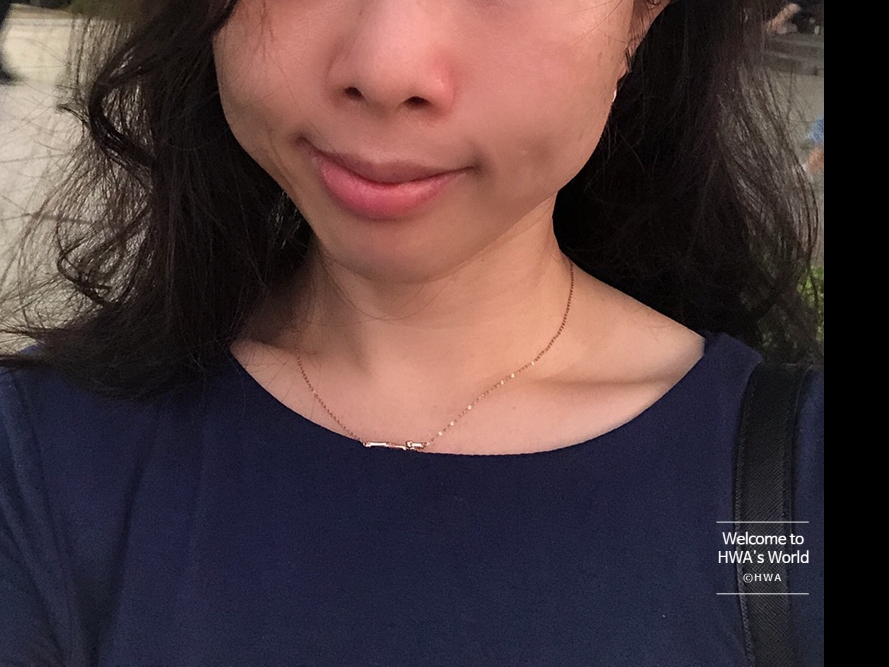 [강남/보스] 코볼 환원주사 - 리뷰 및 가격정보 2