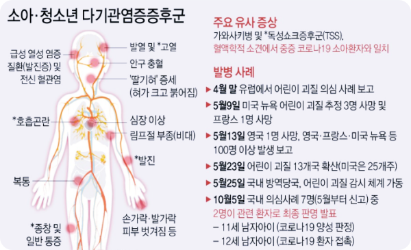  14세 여학생, 국내 3번째 다기관염증증후군 발생...현재 회복 중
